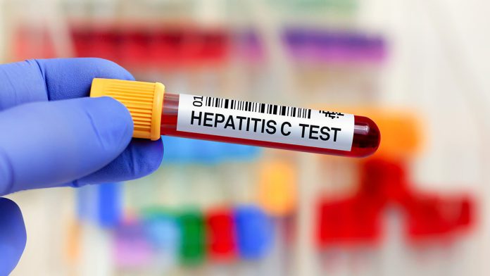 FDA Approves First Rapid Test for Hepatitis C, Enabling Quick Diagnosis and Treatment