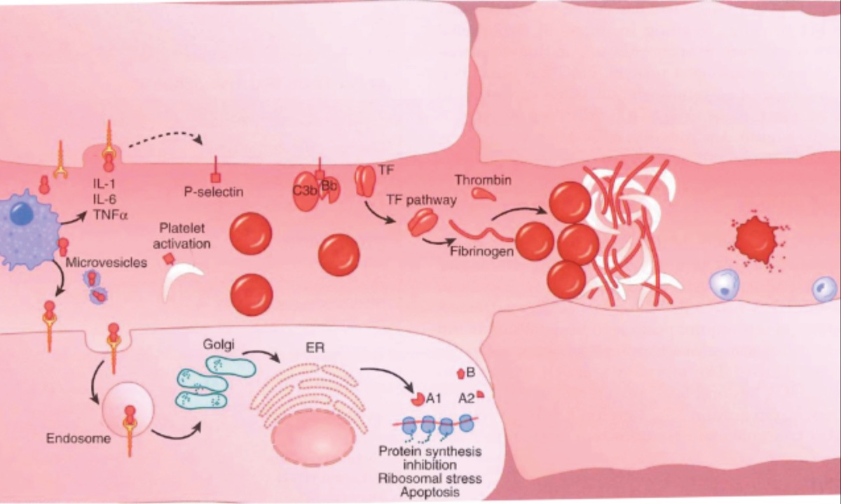 Italy Reports 68 Cases of Hemolytic Uremic Syndrome in Past Year, Highlighting Regional and Age Disparities